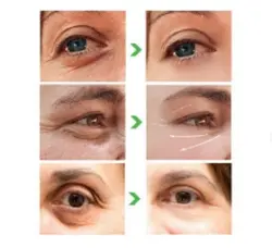 دور چشم ترمیم کننده خاویار کیانزی