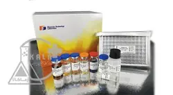 مشخصات، قیمت و خرید کیت تشخیص HCV-شرکت Bt-laboratory