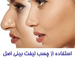چسب لیفت بینی بی رنگ اصل امریکا
