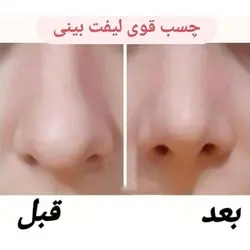 چسب لیفت بینی TGMED