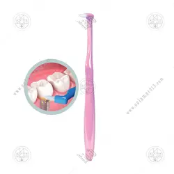 مسواک یونیک ایمپلنت کانفیدنت UNIQUE IMPLANT