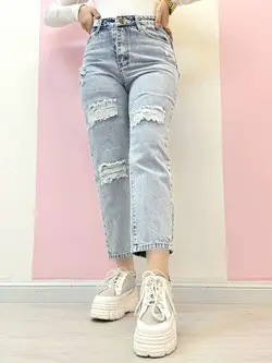 مام‌ ابی‌روشن زانفیکس دار