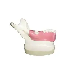 ماکت آموزشی دندان مهردنت | فروشگاه آنلاین تهران دنتیک