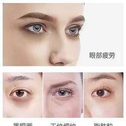 کرم دور چشم خاویار