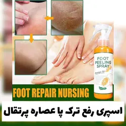 اسپری ترک و خشکی پا foot peeling spray