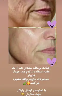 کرم ضدچروک باعصاره خاویار لدورا کر50میلی کد41272