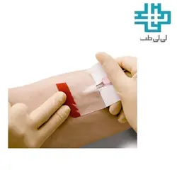 چسب انژیوکت شفاف