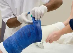 گچ فایبر گلاس