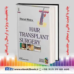 Hair Transplant Surgery 1st Edition