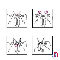 بند انداز سورکرSK-300 Surker Hair Remover - Rokhino