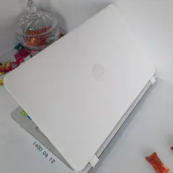 لپ تاپ کارکرده اچ پی Hp 15-P115ne | اطلاع گستر | لب تاپ دست دوم لپتاپ استوک