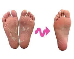 ماسک لایه بردار واسکراب پا بی بیوتی