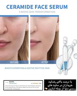 ویال ضد التهاب و آبرسان بیچریBacheri