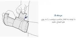مچ بند آتل دار فانکشنال CTS پاک سمن