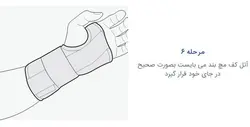 مچ بند آتل دار بلند فانکشنال CTS پاک سمن