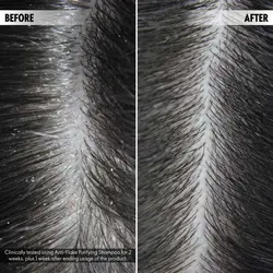 شامپو ضدشوره و ضدپوسته دئولوژی اوریفلیم (44951)