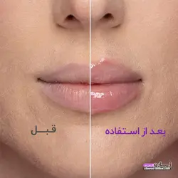 حجم دهنده لب SHEGLAMشیگلم مدلOH EM GEE-HOT GOSS LIP GLOSS حجم6.8گرم  (با ضمانت اصالت کالا-تاریخ انقضا طولانی)