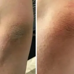 کرم و صابون شیر الاغ