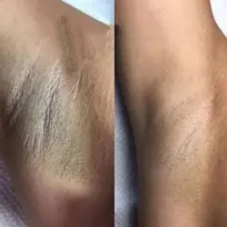 کرم و صابون شیر الاغ