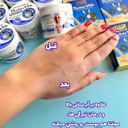 کرم و صابون شیر الاغ