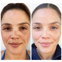 پک ویال روشن و سفید کننده دکتر اسکین