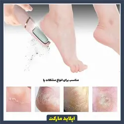 سوهان پا شارژی - سنگ پا شارژی غلطکی