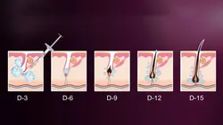 فیلر رشد و تقویت مو هیرفیلر برند DR.CYJ - روناهی کالا