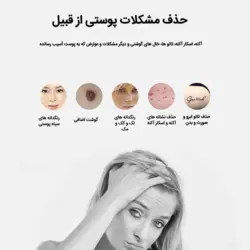 لیزر قلمی حذف تاتو لسکلتون نور آبی مدل LS-058 - روناهی کالا