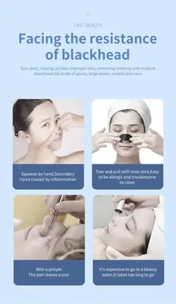 میکرودرم دیجیتالی 5 قدرته هات اند کلد خانگی Blackhead Cold & Hot - روناهی کالا