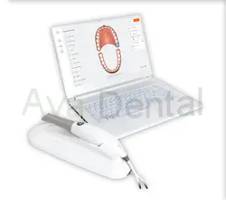 اسکنر داخل دهانی تری دیسک 3Disc مدل Heron IOS | آوادنتال