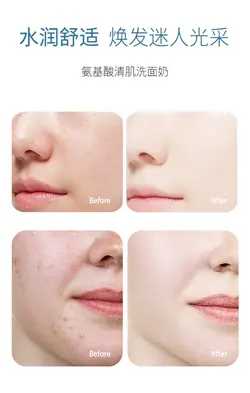 کلینزر آمینو اسید توز