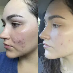 صابون تریاک کلاژن دار