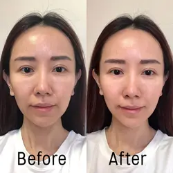 کرم ضد چروک روز مدل هیالورون فیلرSPF15 اوسرین