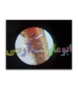 میکروسکوپ اپتیکال 1200 برابر زوم بهمراه تجهیزات و نگهدارنده موبایل