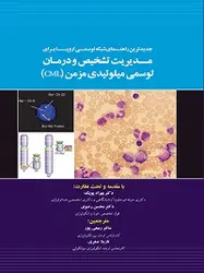 جدیدترین راهنمای شبکه لوسمی اروپا برای مدیریت تشخیص و درمان لوسمی میلوئیدی مرمن (CML)