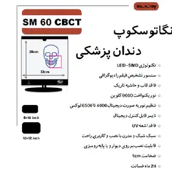 نگاتوسکوپ دندان پزشکی سوئیچ مد مدل SM60 CBCT با پایه S2