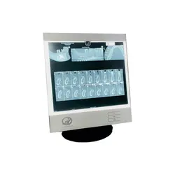نگاتوسکوپ دندان پزشکی سوئیچ مد مدل SM60 CBCT