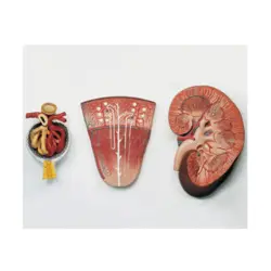 مولاژ کلیه سه قسمتی