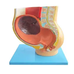 مولاژ حاملگی نمایش جنین 9 ماهه در رحم