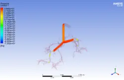 تزریق اسپری استنشاقی آسم به ریه، شبیه سازی با انسیس فلوئنت