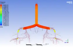 تزریق اسپری استنشاقی آسم به ریه، شبیه سازی با انسیس فلوئنت