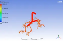 تزریق اسپری استنشاقی آسم به ریه، شبیه سازی با انسیس فلوئنت