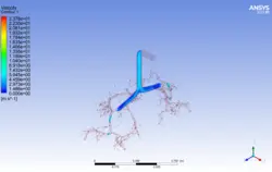 تزریق اسپری استنشاقی آسم به ریه، شبیه سازی با انسیس فلوئنت