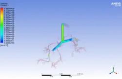 تزریق اسپری استنشاقی آسم به ریه، شبیه سازی با انسیس فلوئنت