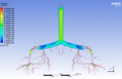 تزریق اسپری استنشاقی آسم به ریه، شبیه سازی با انسیس فلوئنت