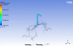 تزریق اسپری استنشاقی آسم به ریه، شبیه سازی با انسیس فلوئنت