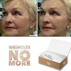 کرم بوتاکس فوری فارماسی