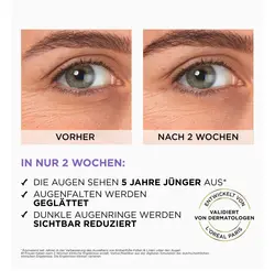 سرم آبرسان و کافئین دور چشم رویتالیفت فیلر لورآل 20ml