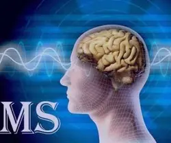 همه چیر درمورد بیماری ام اس (بیماری MS ) و روش های درمان آن