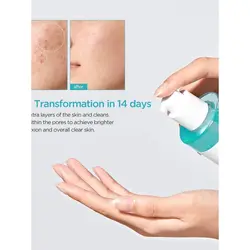 تونر آنوا BHA 2% لایه بردار Anua BHA 2% Gentle Exfoliating Toner